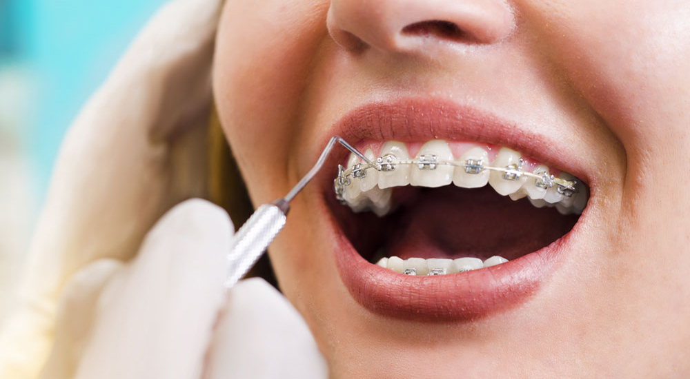 Orthodontics Dentistry